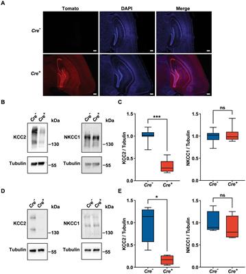 Conditional deletion of KCC2 impairs synaptic plasticity and both spatial and nonspatial memory